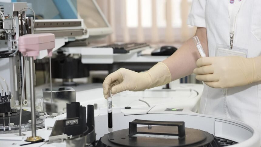 Atenție la hepatita A: șapte focare și aproape 150 de îmbolnăviri într-un județ din România, cu sute de persoane monitorizate 1 sapte focare de hepatita a confirmate intr un judet din romania aproape 150 de imbolnaviri si sute de persoane monitorizate 68dbc46e71dc5